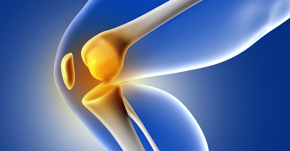 Artroscopia de rodilla por lesión meniscal
